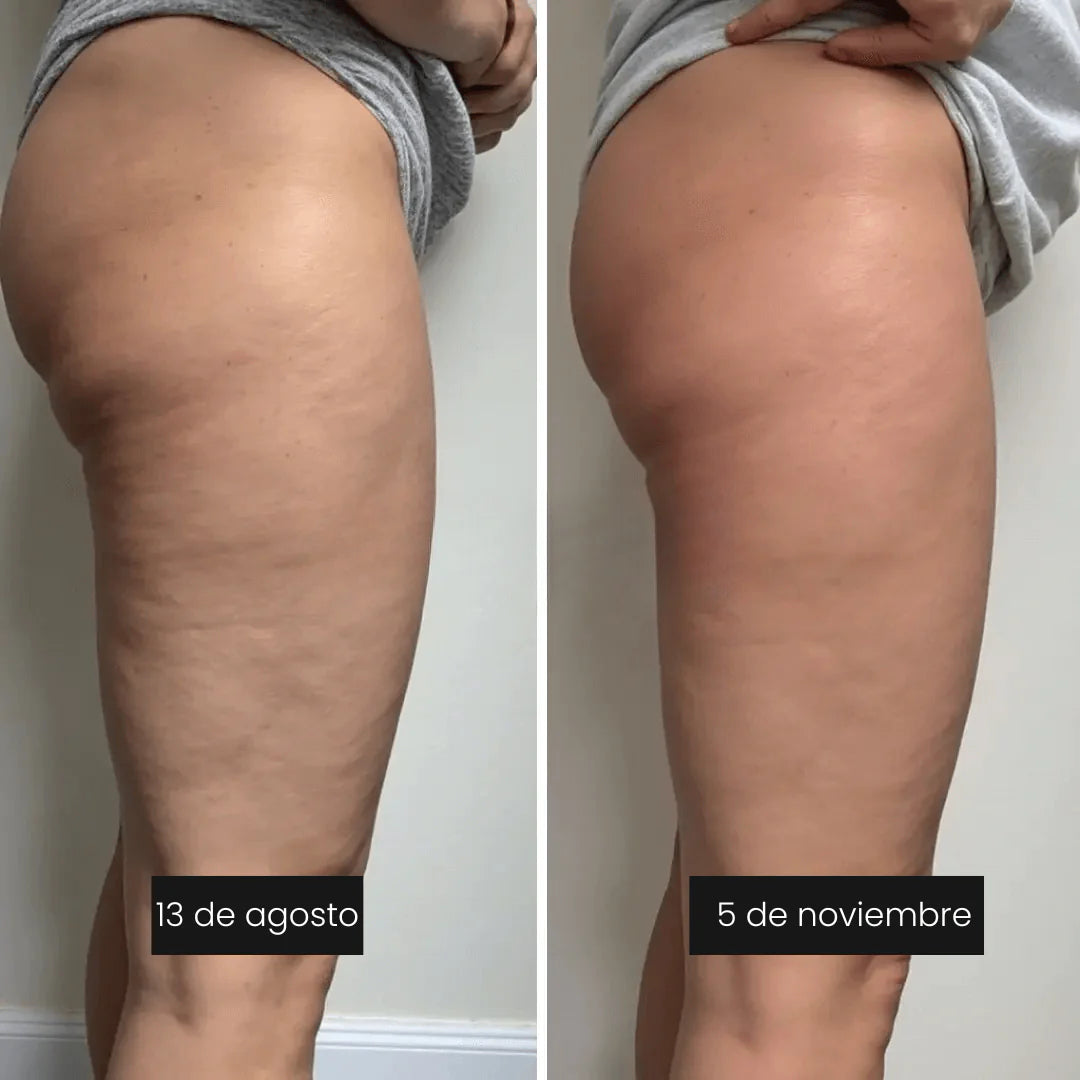 LEGGINGS 3D ANTICELULITIS Y MOLDEADORES